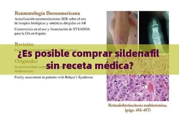 ¿Es posible comprar sildenafil sin receta médica?